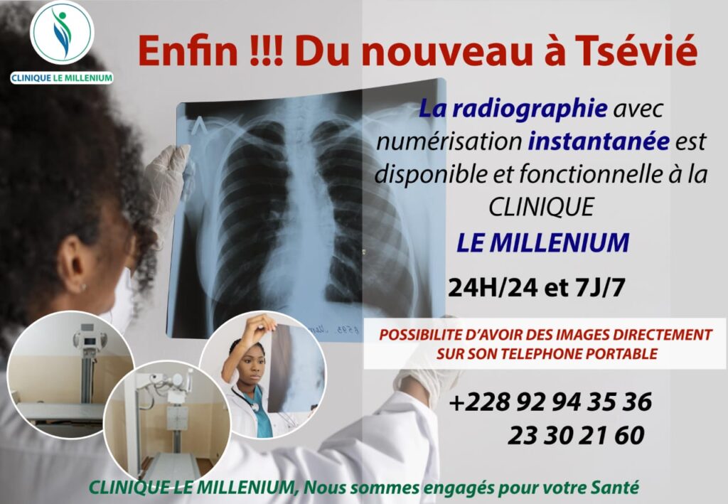 radiographie CLINIQUE LE MILLENIUM